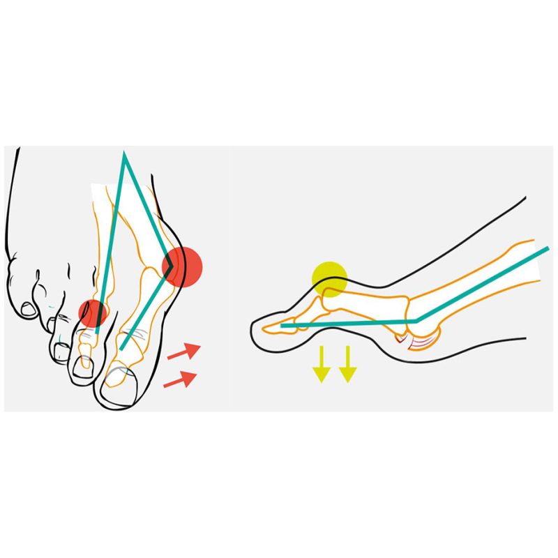 compressana_tape_loop_info2